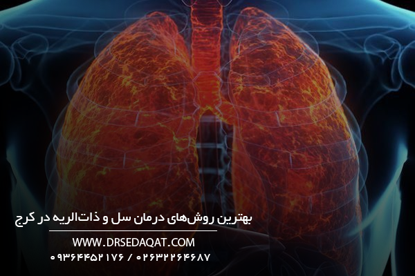 بهترین روش‌های درمان سل و ذات‌الریه در کرج