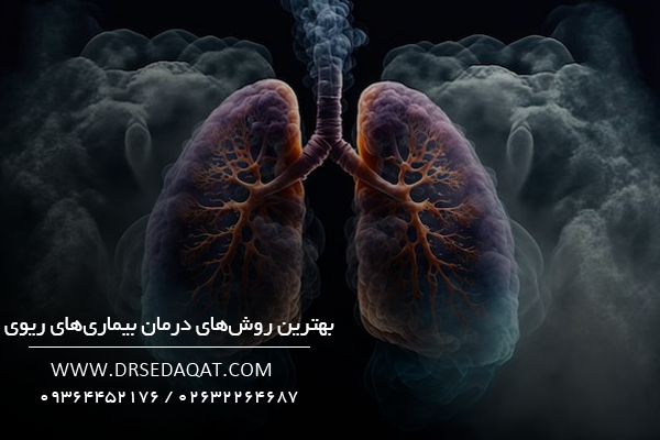 بهترین روش‌های درمان بیماری‌های ریوی