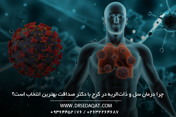 چرا-درمان-سل-و-ذات_الریه-در-کرج-با-دکتر-صداقت-بهترین-انتخاب-است؟
